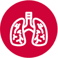 Lung Cancer