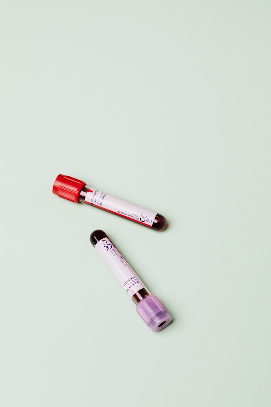 Low Blood Counts or Iron Deficiency (Anemia)
