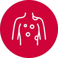 Melanoma icon