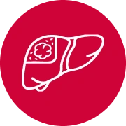 Hepatocellular cancer icon