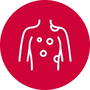 Sarcoma, Melanoma & Rare Tumours icon