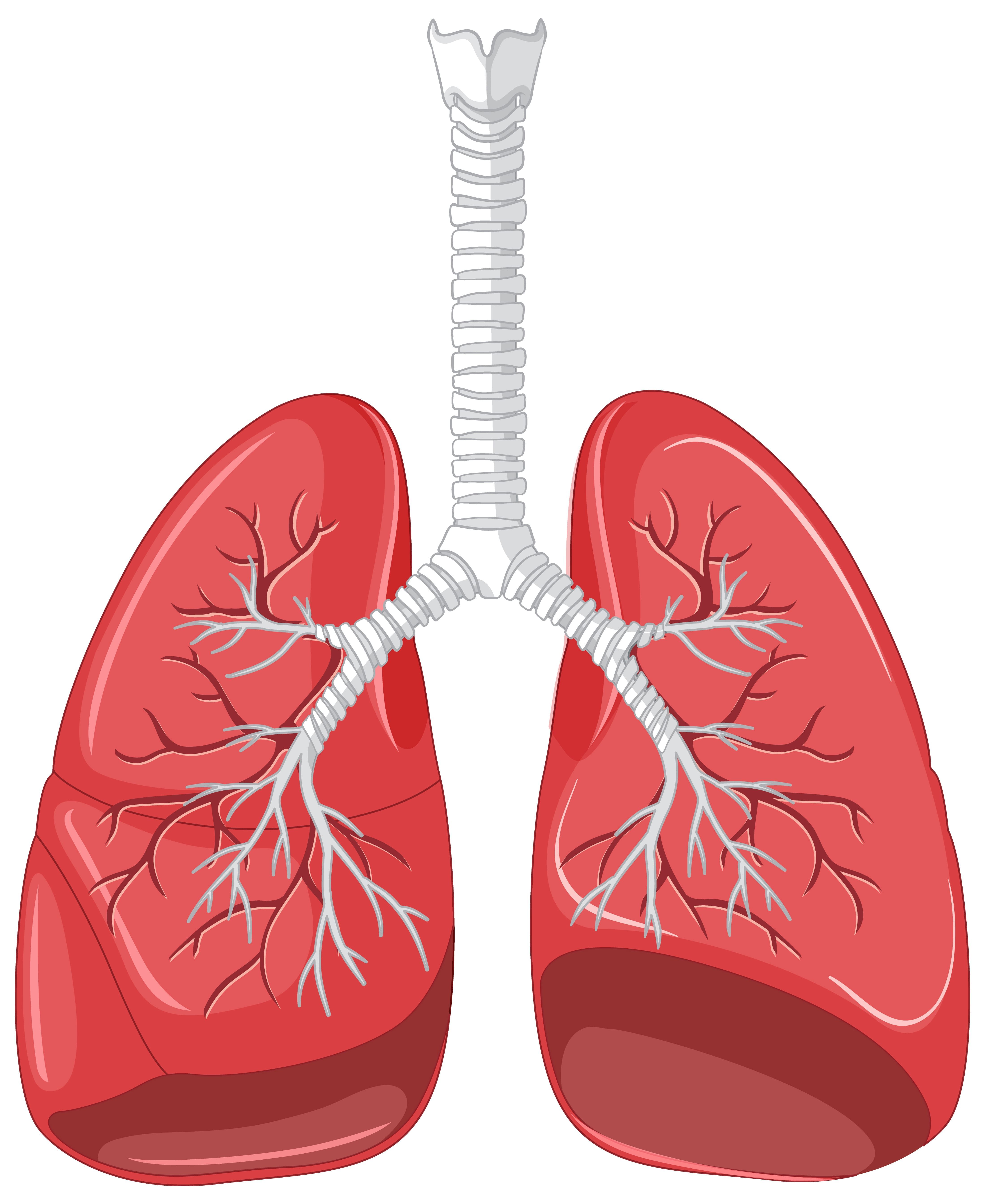 Comparison of small cell and non-small cell lung cancer